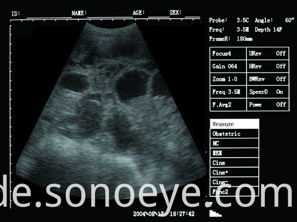 v5 pet ultrasound